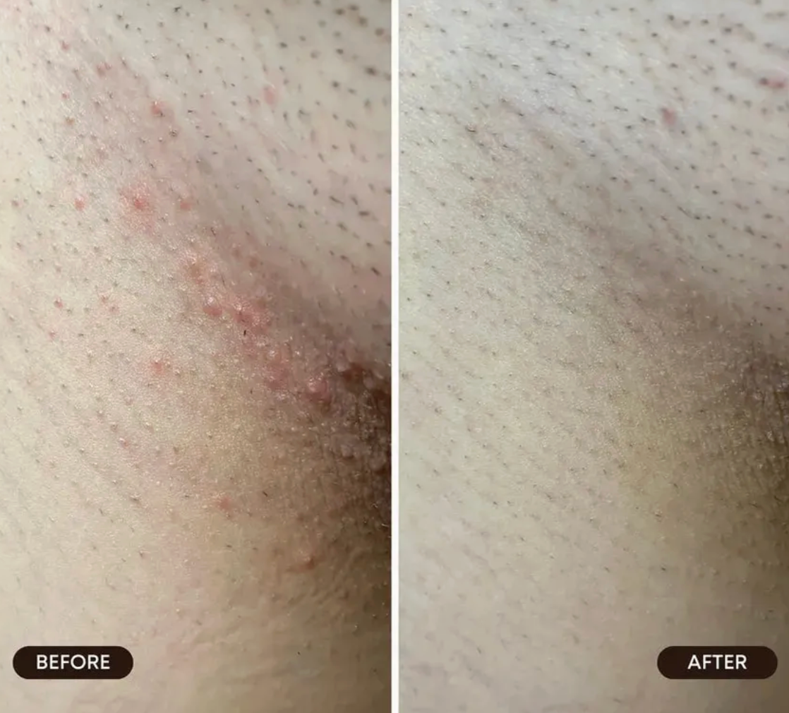 Bushbalm Berry Crush Limited-Edition Ingrown Hair Scrub